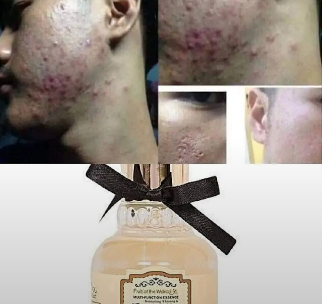 Fruit Of The Wokali Enzyme Moisturizing serum
